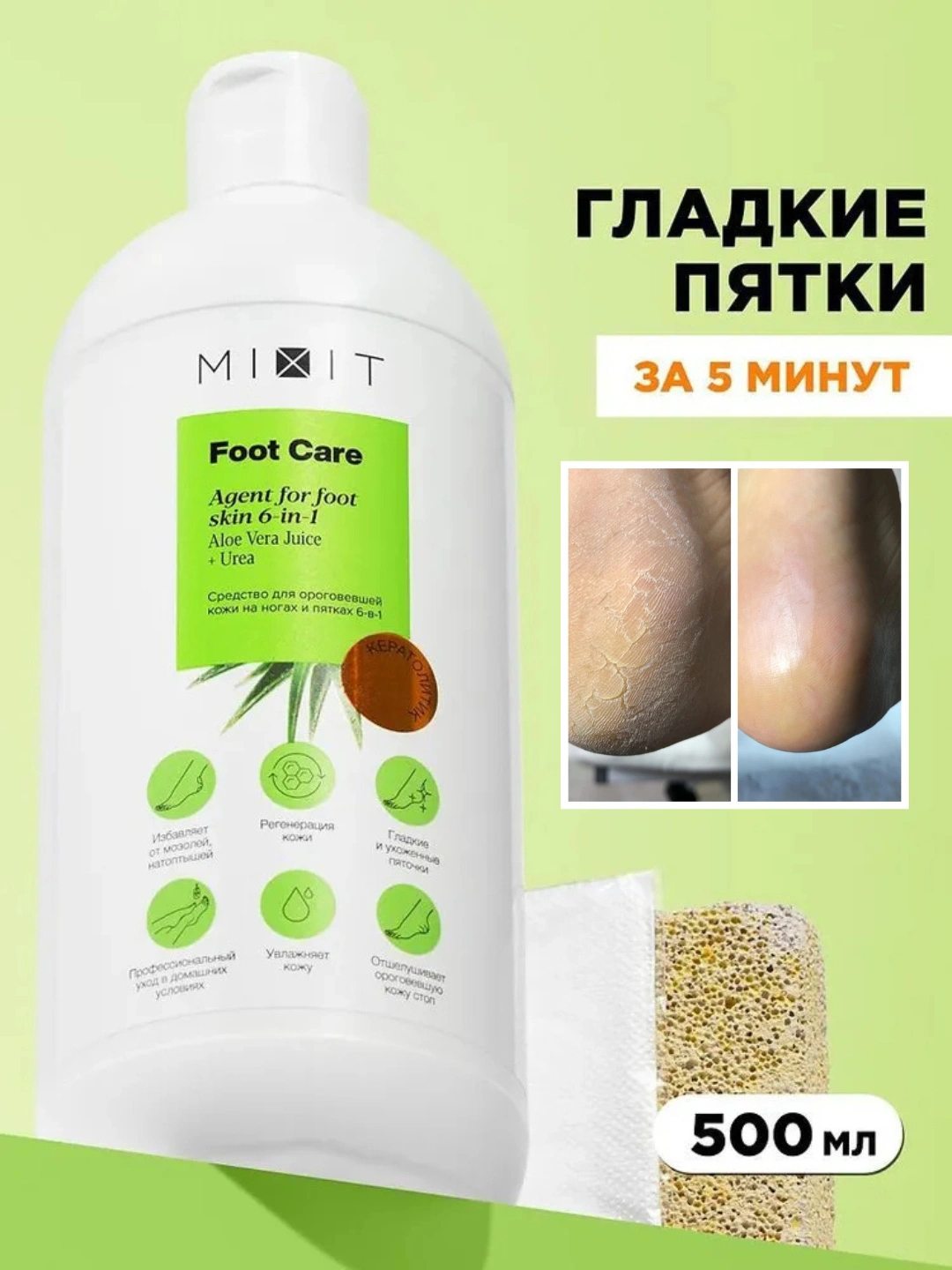Средство для ороговевшей кожи на ногах и пятках MIXIT FOOT CARE Agent for foot skin 6-in-1 500мл